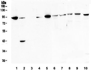 Western blot testing of 1) human K562, 2) human HEK293, 3) human PANC-1, 4) human SW620, 5) human SGC-7901, 6) rat lung, 7) rat liver, 8) mouse spleen, 9) mouse spleen and 10) mouse lung lysate with STAT5b antibody. Predicted/observed molecular weight ~90 kDa.