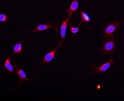 Immunofluorescent staining of human U-2 OS cells with STAT5b antibody (red) and DAPI nuclear stain (blue).