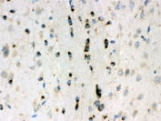 IHC testing of FFPE mouse brain with Lumican antibody. HIER: Boil the paraffin sections in pH 6, 10mM citrate buffer for 20 minutes and allow to cool prior to staining.