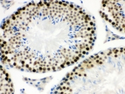 IHC testing of FFPE mouse testis with MNAT1 antibody. HIER: Boil the paraffin sections in pH 6, 10mM citrate buffer for 20 minutes and allow to cool prior to staining.