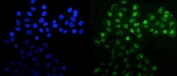 Immunofluorescent staining of FFPE human A431 cells with MNAT1 antibody (green) and DAPI nuclear stain (blue). HIER: steam section in pH6 citrate buffer for 20 min.