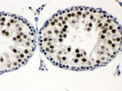 IHC testing of FFPE rat testis with MNAT1 antibody. HIER: Boil the paraffin sections in pH 6, 10mM citrate buffer for 20 minutes and allow to cool prior to staining.