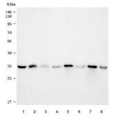 Western blot testing of 1) human HeLa, 2) human A431, 3) human A375, 4) human MCF7, 5) rat testis, 6) rat L6, 7) mouse testis and 8) mouse NIH 3T3 cell lysate with MNAT1 antibody. Expected molecular weight ~36 kDa.
