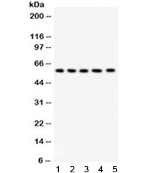 Western blot testing of 1) rat testis, 2) rat liver, 3) human placenta, 4) MCF7 and 5) HeLa lysate with AGFG1 antibody. Expected/observed molecular weight ~58 kDa.