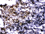 IHC testing of FFPE mouse lymph node with PLK1 antibody. HIER: Boil the paraffin sections in pH 6, 10mM citrate buffer for 20 minutes and allow to cool prior to staining.