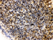 IHC testing of FFPE rat lymph node with PLK1 antibody. HIER: Boil the paraffin sections in pH 6, 10mM citrate buffer for 20 minutes and allow to cool prior to staining.
