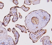 IHC testing of FFPE human placental tissue with Fos B antibody. HIER: Boil the paraffin sections in pH8 EDTA for 20 minutes and allow to cool prior to staining.