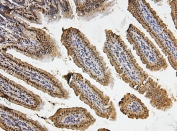 IHC testing of FFPE mouse intestinal tissue with Fos B antibody. HIER: Boil the paraffin sections in pH8 EDTA for 20 minutes and allow to cool prior to staining.