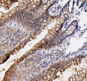 IHC testing of FFPE rat intestinal tissue with Fos B antibody. HIER: Boil the paraffin sections in pH8 EDTA for 20 minutes and allow to cool prior to staining.