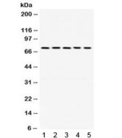 Western blot testing of 1) rat brain, 2) mouse stomach, human 3) HeLa, 4) U87 and 5) SKOV lysate with LIMK antibody. Expeccted/observed molecular weight ~72 kDa.