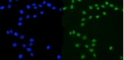 Immunofluorescent staining of FFPE human MCF7 cells with ATXN3 antibody (green) and DAPI nuclear stain (blue). HIER: steam section in pH6 citrate buffer for 20 min.