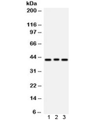 Western blot testing of 1) rat brain, 2) human COLO320 and 3) HeLa lysate with ATXN3 antibody. Predicted/observed molecular weight ~42 kDa.