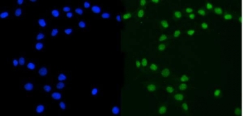 Immunofluorescent staining of FFPE human MCF7 cells with ATXN3 antibody (green) and DAPI nuclear stain (blue). HIER: steam section in pH6 citrate buffer for 20 min.