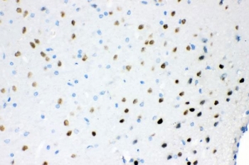 IHC staining of FFPE rat brain tissue with ATXN1 antibody. HIER: boil tissue sections in pH8 EDTA for 20 min and allow to cool before testing.