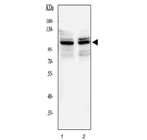Western blot testing of 1) rat brain and 2) mouse brain tissue lysate with ATXN1 antibody. Commonly observed molecular weight: 87-105 kDa.