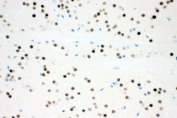 IHC staining of FFPE mouse brain tissue with ATXN1 antibody. HIER: boil tissue sections in pH8 EDTA for 20 min and allow to cool before testing.