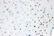 IHC staining of FFPE rat brain tissue with ATXN1 antibody. HIER: boil tissue sections in pH8 EDTA for 20 min and allow to cool before testing.