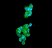 Immunofluorescent staining of FFPE human HepG2 cells with ATXN1 antibody (green) and DAPI nuclear stain (blue). HIER: steam section in pH6 citrate buffer for 20 min.