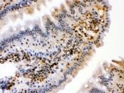 IHC testing of FFPE mouse intestine with HSPA2 antibody. HIER: Boil the paraffin sections in pH 6, 10mM citrate buffer for 20 minutes and allow to cool prior to staining.