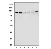 Western blot testing of 1) human U-251, 2) human HEL, 3) rat testis, 4) rat brain, 5) mouse testis and 6) mouse brain tissue lysate with EPHB1 antibody. Expected/observed molecular weight ~111 kDa.