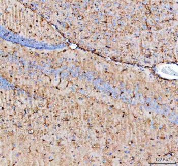 IHC testing of FFPE mouse brain with AQP4 antibody. HIER: Boil the paraffin sections in pH 6, 10mM citrate buffer for 20 minutes and allow to cool prior to staining.