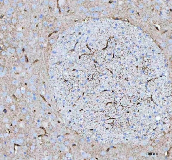 IHC testing of FFPE rat brain with AQP4 antibody. HIER: Boil the paraffin sections in pH 6, 10mM citrate buffer for 20 minutes and allow to cool prior to staining.
