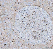 IHC testing of FFPE rat brain with AQP4 antibody. HIER: Boil the paraffin sections in pH 8 EDTA buffer for 20 minutes and allow to cool prior to staining.