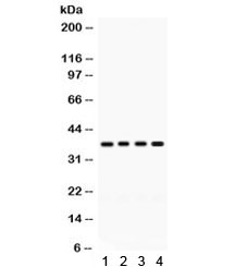 Western blot testing of 1) rat liver, 2) rat pancreas, 3) mouse liver and 4) human HeLa lysate with FOXA3 antibody. Expected/observed molecular weight ~37 kDa.