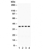 Western blot testing of 1) rat liver, 2) rat pancreas, 3) mouse liver and 4) human HeLa lysate with FOXA3 antibody. Expected/observed molecular weight ~37 kDa.