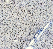 IHC staining of FFPE mouse liver tissue with FOXA3 antibody. HIER: boil tissue sections in pH8 EDTA for 20 min and allow to cool before testing.