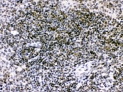 IHC testing of FFPE mouse spleen with RAG2 antibody. HIER: Boil the paraffin sections in pH 6, 10mM citrate buffer for 20 minutes and allow to cool prior to staining.