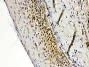 IHC testing of FFPE human tonsil with RAG2 antibody. HIER: Boil the paraffin sections in pH 6, 10mM citrate buffer for 20 minutes and allow to cool prior to staining.