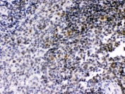 IHC testing of FFPE rat spleen with RAG2 antibody. HIER: Boil the paraffin sections in pH 6, 10mM citrate buffer for 20 minutes and allow to cool prior to staining.