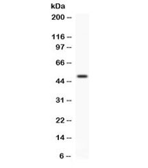 Western blot testing of human A549 cell lysate with FCGRT antibody. Expected/observed molecular weight ~51 kDa.~