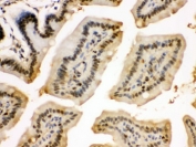 IHC testing of FFPE mouse intestine with Eukaryotic Translation Initiation Factor 6 antibody. HIER: Boil the paraffin sections in pH 6, 10mM citrate buffer for 20 minutes and allow to cool prior to staining.