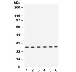Western blot testing of 1) rat heart, 2) rat liver, 3) mouse liver, 4) human placenta, 5) COLO320 and 6) HeLa lysate with Eukaryotic Translation Initiation Factor 6 antibody. Expected/observed molecular weight ~27 kDa.