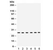 Western blot testing of 1) rat heart, 2) rat liver, 3) mouse liver, 4) human placenta, 5) COLO320 and 6) HeLa lysate with Eukaryotic Translation Initiation Factor 6 antibody. Expected molecular weight ~27 kDa.