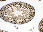 IHC testing of FFPE rat testis with Eukaryotic Translation Initiation Factor 6 antibody. HIER: Boil the paraffin sections in pH 6, 10mM citrate buffer for 20 minutes and allow to cool prior to staining.