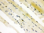 IHC testing of FFPE rat skeletal muscle with CTBP2 antibody. HIER: Boil the paraffin sections in pH 6, 10mM citrate buffer for 20 minutes and allow to cool prior to staining.