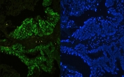 Immunofluorescent staining of FFPE human colon with CTBP2 antibody (green) at 1ug/ml and DAPI nuclear stain (blue). HIER: steam section in pH6 citrate buffer for 20 min.