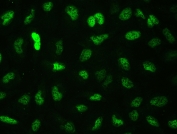Immunofluorescent staining of FFPE human U-2 OS cells with CTBP2 antibody (green) at 2ug/ml. HIER: steam section in pH6 citrate buffer for 20 min.