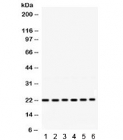 Western blot testing of 1) rat brain, 2) mouse thymus, 3) mouse brain, 4) human HeLa, 5) MCF7 and 6) COLO320 lysate with RAB10 antibody. Expected/observed molecular weight ~22 kDa.