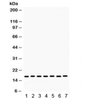 Western blot testing of 1) rat intestine, 2) rat kidney, 3) rat liver, and human 4) HeLa, 5) SW620, 6) 293 and 7) HepG2 lysate with Lysozyme antibody. Expected/observed molecular weight ~17 kDa.