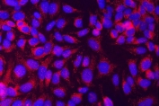 Immunofluorescent staining of FFPE human HeLa cells with MUNC18-1 antibody (red) and DAPI nuclear stain (blue). HIER: steam section in pH6 citrate buffer for 20 min.