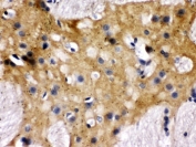 IHC testing of FFPE rat brain with MUNC18-1 antibody. HIER: Boil the paraffin sections in pH 6, 10mM citrate buffer for 20 minutes and allow to cool prior to staining.