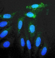 IF/ICC staining of FFPE human A549 cells with RAB11 antibody (green) at 2ug/ml and DAPI nuclear stain (blue). HIER: steam section in pH6 citrate buffer for 20 min.