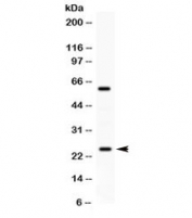 Western blot testing of human A549 cell lysate with RAB11 antibody. Expected molecular weight ~24 kDa.