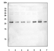 Western blot testing of human 1) 293T, 2) SH-SY5Y, 3) HeLa, 4) MCF7, 5) A549, 6) RT4 and 7) HaCaT cell lysate with RAB11 antibody. Predicted molecular weight ~24 kDa.