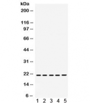 Western blot testing of 1) rat brain, 2) rat liver, 3) rat kidney, 4) human MCF7 and 5) human SW620 lysate with RAPA1 antibody. Expected molecular weight ~21 kDa.