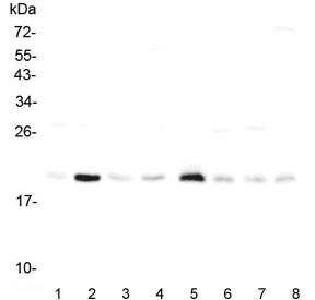 Western blot testing of rat 1) heart, 2) lung, 3) stomach, 4) kidney and mouse 5) heart, 6) lung, 7) stomach and 8) kidney lysate with RAP1A antibody. Expected molecular weight ~21 kDa.~